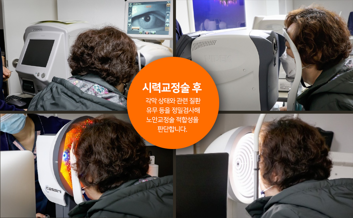 시력교정술 후 각막 상태와 관련 질환 유무 등을 정밀검사해 노안교정술 적합성을 판단합니다.