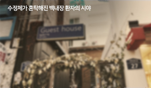 수정체가 혼탁해진 백내장 환자의 시야
