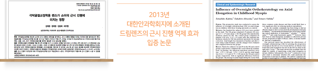 2013년 대한안과학회지에 소개된 드림렌즈의 근시 진행 억제 효과 입증 논문