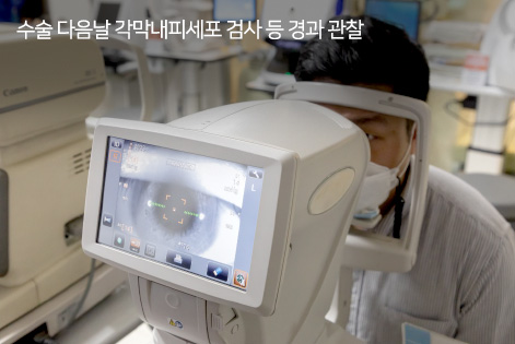 수술 다음날 각막내피세포 검사 등 경과 관찰