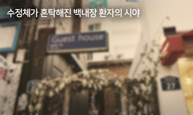 수정차게 혼탁해진 백내장 환자의 시야