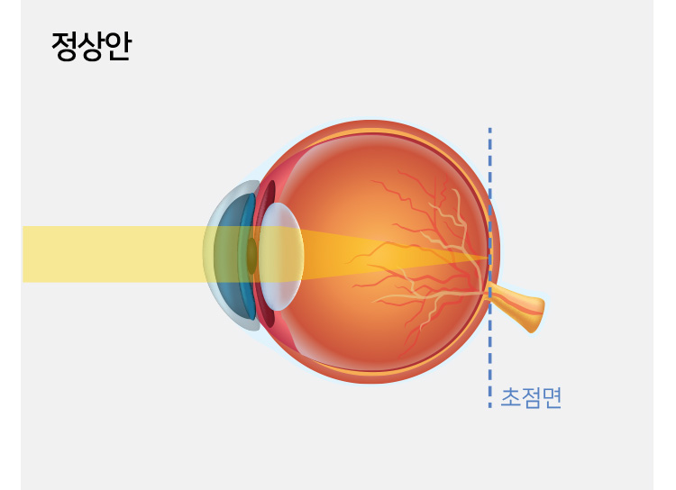 정상안