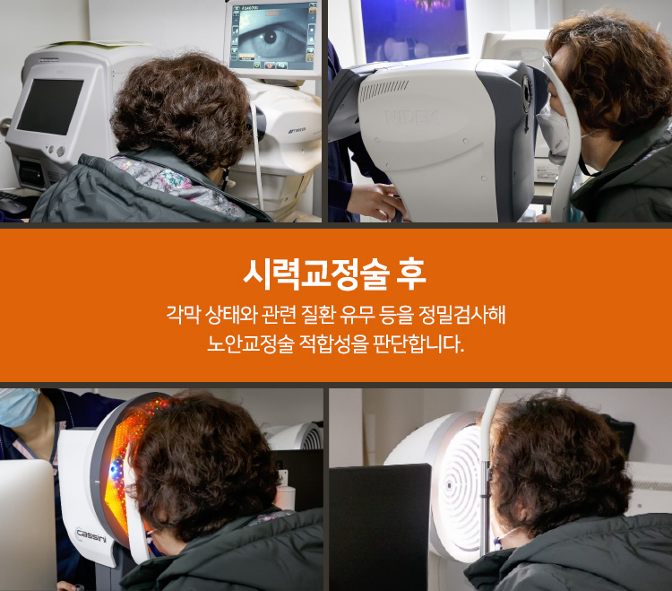 시력교정술 후 각막 상태와 관련 질환 유무 등을 정밀검사해 노안교정술 적합성을 판단합니다.