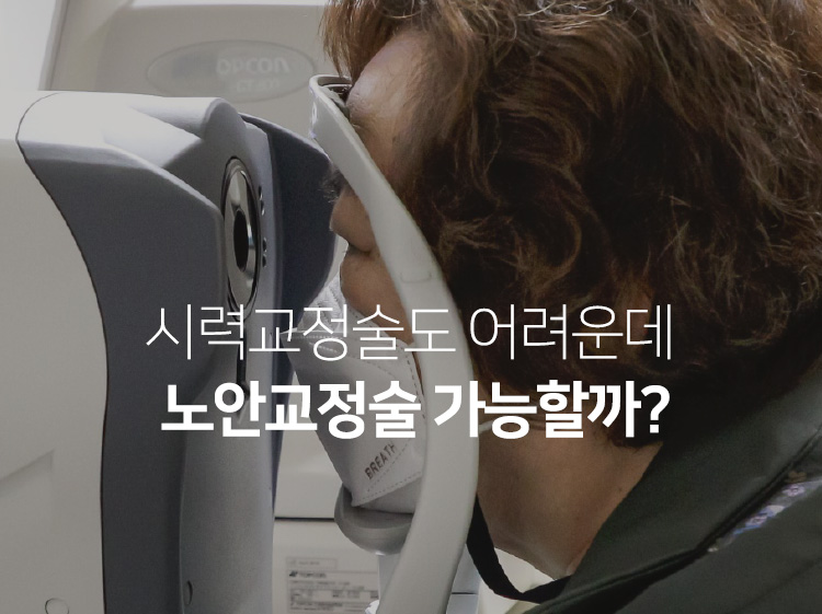 시력교정술도 어려운데 노안교정술 가능할까?
