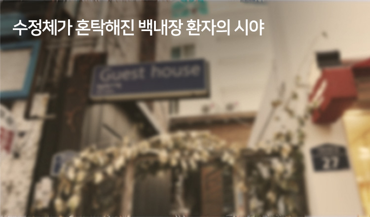 수정체가 혼탁해진 백내장 환자의 시야