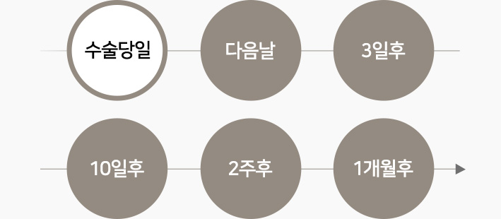 수술당일-다음날-3일후-10일후-2주후-1개월후