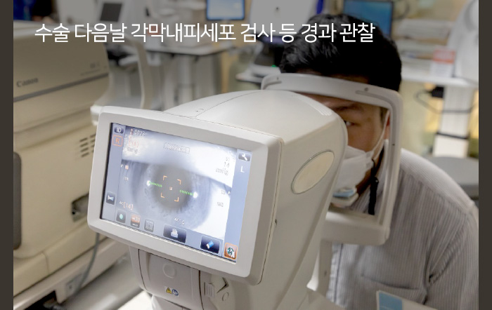 수술 다음날 각막내피세포 검사 등 경과 관찰