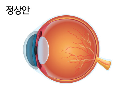 정상안